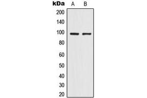 Western blot analysis of TRPV4 expression in HepG2 (A), HeLa (B) whole cell lysates. (TRPV4 Antikörper  (Center))