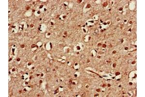 Immunohistochemistry of paraffin-embedded human brain tissue using ABIN7171556 at dilution of 1:100 (TAF1A Antikörper  (AA 251-325))
