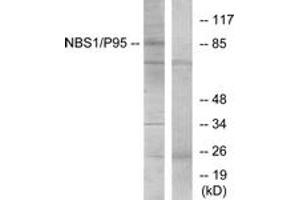 Western blot analysis of extracts from Jurkat cells, using p95/NBS1 (Ab-343) Antibody. (Nibrin Antikörper  (AA 310-359))