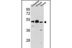 BTBD17 Antibody (C-term) (ABIN655567 and ABIN2845068) western blot analysis in mouse bladder,heart,liver tissue lysates (35 μg/lane). (BTBD17 Antikörper  (C-Term))