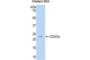 Western blot analysis of the recombinant protein. (Peroxiredoxin 2 Antikörper  (AA 6-164))