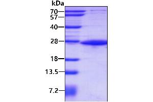 E3 Ubiquitin-Protein Ligase SIAH1 (SIAH1) (AA 90-282) protein (His tag)