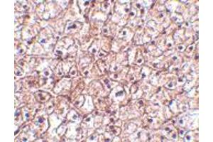 Immunohistochemistry of IFNB1 in human liver tissue with IFNB1 polyclonal antibody  at 5 ug/mL .