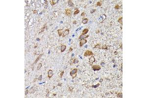 Immunohistochemistry of paraffin-embedded mouse spinal cord using MTHFD1L Rabbit pAb (ABIN6132366, ABIN6144142, ABIN6144143 and ABIN6223977) at dilution of 1:200 (40x lens). (MTHFD1L Antikörper  (AA 759-978))