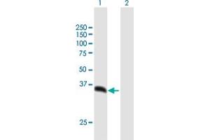 Western Blot analysis of PSMD14 expression in transfected 293T cell line by PSMD14 MaxPab polyclonal antibody. (PSMD14 Antikörper  (AA 1-310))