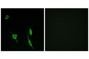 Immunofluorescence (IF) image for anti-Deleted in Colorectal Carcinoma (DCC) (Internal Region) antibody (ABIN1850423) (DCC Antikörper  (Internal Region))