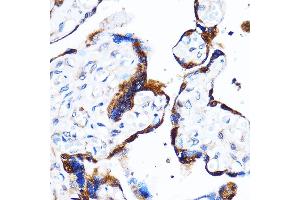Immunohistochemistry of paraffin-embedded Human placenta using p38 MAPK Rabbit pAb (ABIN7268616) at dilution of 1:100 (40x lens). (MAPK14 Antikörper  (C-Term))