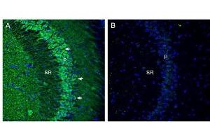 Expression of Cortactin in mouse hippocampus. (Cortactin (CTTN) Peptid)