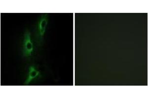 Immunofluorescence analysis of NIH-3T3 cells, using ADRB2 Antibody. (beta 2 Adrenergic Receptor Antikörper  (AA 201-250))