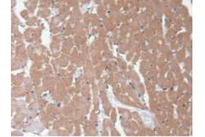 IHC-P analysis of Rat Heart Tissue, with DAB staining. (CAMK2A Antikörper  (AA 1-478))