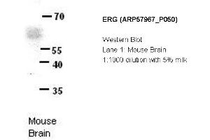 Image no. 2 for anti-ERG, ETS transcription factor (ERG) (N-Term) antibody (ABIN406640) (ERG Antikörper  (N-Term))