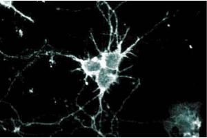 Immunofluorescence staining of rat neurons at 5 µg/ml of the anti-Ral A antibody. (rala Antikörper  (AA 35-206))