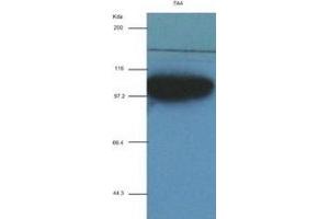 ACTN1 antibody (7A4) at 1:2000 + recombinant human ACTN1 (ACTN1 Antikörper  (AA 650-893))