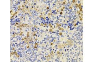 Immunohistochemistry of paraffin-embedded Rat spleen using PRDM5 Polyclonal Antibody at dilution of 1:100 (40x lens). (PRDM5 Antikörper)