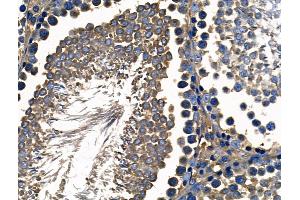 ABIN6261894 and ABIN6268716 at 1/100 staining Rat testis tissue by IHC-P. (GATA5 Antikörper  (Internal Region))