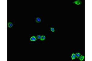 Immunofluorescent analysis of HepG2 cells using ABIN7167280 at dilution of 1:100 and Alexa Fluor 488-congugated AffiniPure Goat Anti-Rabbit IgG(H+L) (RAB28 Antikörper  (AA 98-218))