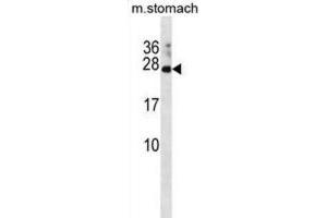 Western Blotting (WB) image for anti-RAP2C, Member of RAS Oncogene Family (RAP2C) antibody (ABIN3001185) (RAP2C Antikörper)
