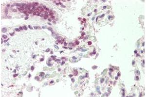 Human, Lung: Formalin-Fixed Paraffin-Embedded (FFPE) (DNAJB1 Antikörper  (AA 74-123))