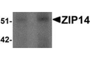 Western Blotting (WB) image for anti-Solute Carrier Family 39 (Zinc Transporter), Member 14 (SLC39A14) (Center) antibody (ABIN783817)