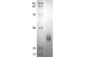Western Blotting (WB) image for Inosine Triphosphatase (ITPA) (Transcript Variant 1) protein (His tag) (ABIN2723912)