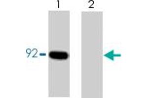 Western blot analysis of CTNNB1 immunoprecipitated from lysates prepared from A-431 cells treated with pervanadate. (CTNNB1 Antikörper  (pTyr86))