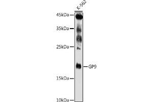 Western blot analysis of extracts of K-562 cells, using GP9 antibody (ABIN6127598, ABIN6141293, ABIN6141294 and ABIN6221019) at 1:500 dilution.