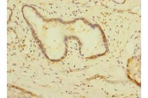 Immunohistochemistry of paraffin-embedded human pancreatic tissue using ABIN7158909 at dilution of 1:100 (MPP6 Antikörper  (AA 220-420))