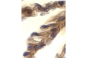 Immunohistochemistry of TRIF in human lung tissue with this product at 10 μg/ml. (TICAM1 Antikörper  (C-Term))