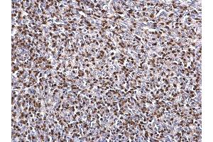 IHC-P Image ZAP70 antibody detects ZAP70 protein at nucleus on mouse lymph node by immunohistochemical analysis.