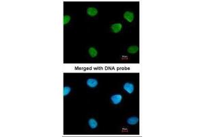 ICC/IF Image Immunofluorescence analysis of paraformaldehyde-fixed HeLa, using PARP1, antibody at 1:200 dilution. (PARP1 Antikörper)