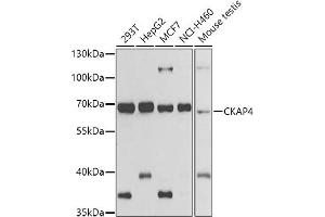Western blot analysis of extracts of various cell lines, using CK antibody (ABIN6134474, ABIN6138645, ABIN6138646 and ABIN6223731) at 1:500 dilution. (CKAP4 Antikörper)