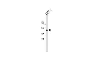 Anti-ETS2 Antibody (Center) at 1:2000 dilution + MCF-7 whole cell lysate Lysates/proteins at 20 μg per lane. (ETS2 Antikörper  (AA 146-173))