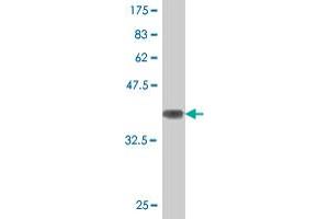 Western Blot detection against Immunogen (36. (ATG5 Antikörper  (AA 176-275))