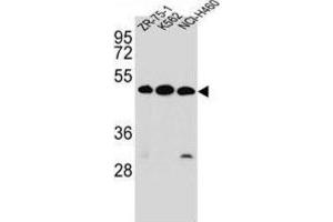 Western Blotting (WB) image for anti-Kringle Containing Transmembrane Protein 2 (KREMEN2) antibody (ABIN2997109) (KREMEN2 Antikörper)