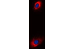 Immunofluorescent analysis of ANT4 staining in K562 cells.