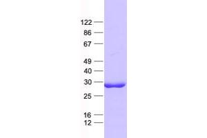 Western Blotting (WB) image for Excision Repair Cross-Complementing Rodent Repair Deficiency, Complementation Group 8 (ERCC8) protein (His tag) (ABIN2720444)
