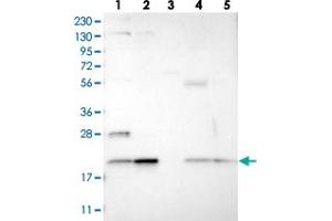 Western blot analysis of Lane 1: RT-4, Lane 2: U-251 MG, Lane 3: Human Plasma, Lane 4: Liver, Lane 5: Tonsil with TMEM65 polyclonal antibody  at 1:250-1:500 dilution. (TMEM65 Antikörper)