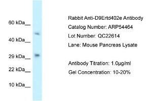 Western Blotting (WB) image for anti-T Cell Activation Inhibitor, Mitochondrial (TCAIM) (N-Term) antibody (ABIN2785726) (TCAIM Antikörper  (N-Term))
