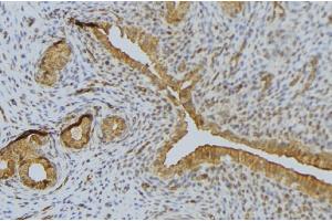 ABIN6276635 at 1/100 staining Human uterus tissue by IHC-P. (Syndecan 1 Antikörper  (C-Term))