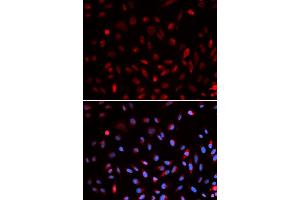 Immunofluorescence analysis of U2OS cells using ERCC1 antibody (ABIN5973037). (ERCC1 Antikörper)