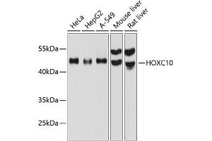 Western blot analysis of extracts of various cell lines, using HOXC10 antibody (ABIN6129025, ABIN6141948, ABIN6141949 and ABIN6215814) at 1:1000 dilution. (HOXC10 Antikörper  (AA 1-260))