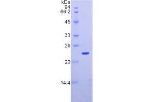 SDS-PAGE analysis of Mouse Integrin alpha M (ITGAM) Protein. (CD11b Protein)