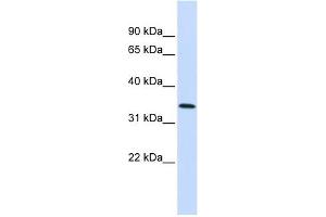 Annexin A4 antibody used at 1 ug/ml to detect target protein. (Annexin IV Antikörper  (Middle Region))