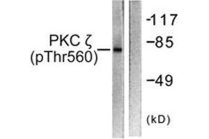 Western blot analysis of extracts from COS7 cells treated with PMA 125ng/ml 30', using PKC zeta (Phospho-Thr560) Antibody. (PKC zeta Antikörper  (pThr560))