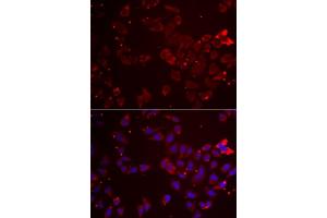 Immunofluorescence analysis of  cells using GATM antibody (ABIN6133283, ABIN6140984, ABIN6140985 and ABIN6222282).