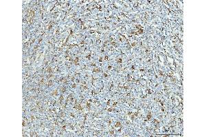 IHC analysis of Grp75 using anti-Grp75 antibody (ABIN7602782). (HSPA9 Antikörper  (C-Term))