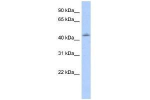 WB Suggested Anti-OTX1 Antibody Titration:  0.