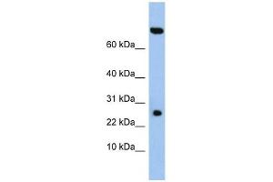 ZSWIM3 antibody used at 1 ug/ml to detect target protein. (ZSWIM3 Antikörper  (N-Term))