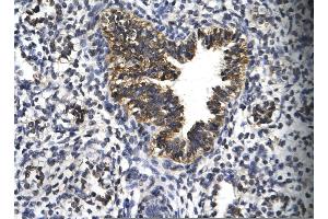 Rabbit Anti-EGR2 Antibody       Paraffin Embedded Tissue:  Human bronchiole epithelium   Cellular Data:  Epithelial cells of renal tubule  Antibody Concentration:   4. (EGR2 Antikörper  (C-Term))