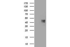 HEK293T cells were transfected with the pCMV6-ENTRY control (Left lane) or pCMV6-ENTRY C1orf161 (Right lane) cDNA for 48 hrs and lysed. (MAB21L3 Antikörper)